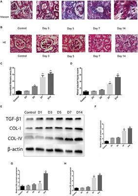 MicroRNA-140-5p Mediates Renal Fibrosis Through TGF-β1/Smad Signaling Pathway by Directly Targeting TGFBR1